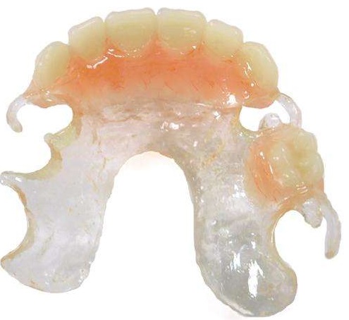 Clearmet