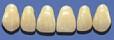 Portrait IPN Upper Ant. Mould 22G (1 X 6)