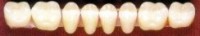 Naturatone Lower Posterior 33 Mould 97 (1x8)